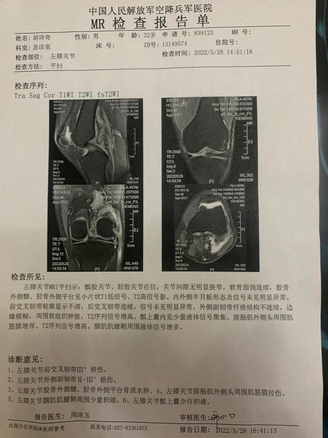 韧带拉伤最好的治疗方法吉松喷雾（韧带拉伤最好的治疗方法针灸）