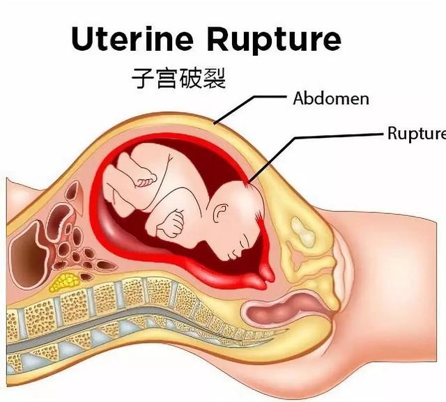 子宫的整体结构示意图（子宫图片结构图正面立体）